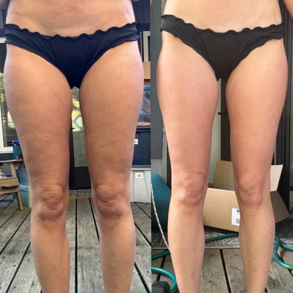 Lumoscu™ - Light the Way to a Sculpted You.